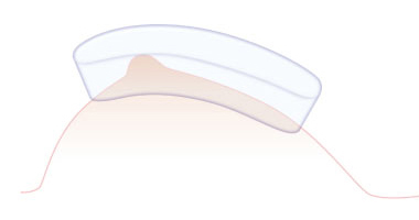 gel-pad.jpg